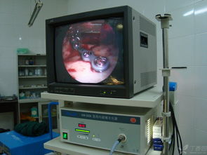 專利產品 內窺鏡輔助新型穿頰器在頜面骨骨折內固定中的應用及計算機軟硬件輔助系統集成